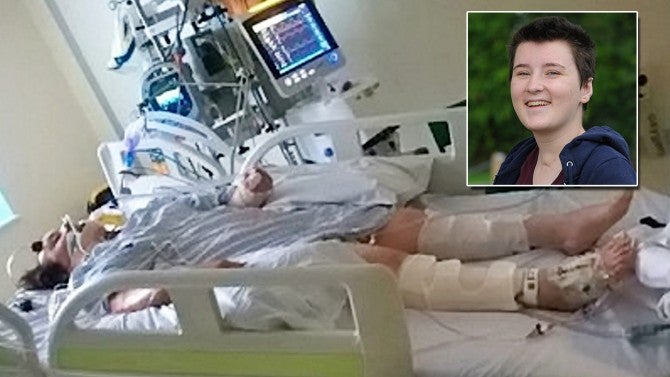 Woman In Coma Wiggled Toe Just As Doctor S Were About To