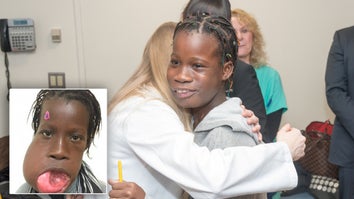 12-Year-Old Girl Smiles Again After 6-Pound Tumor is Removed From ...