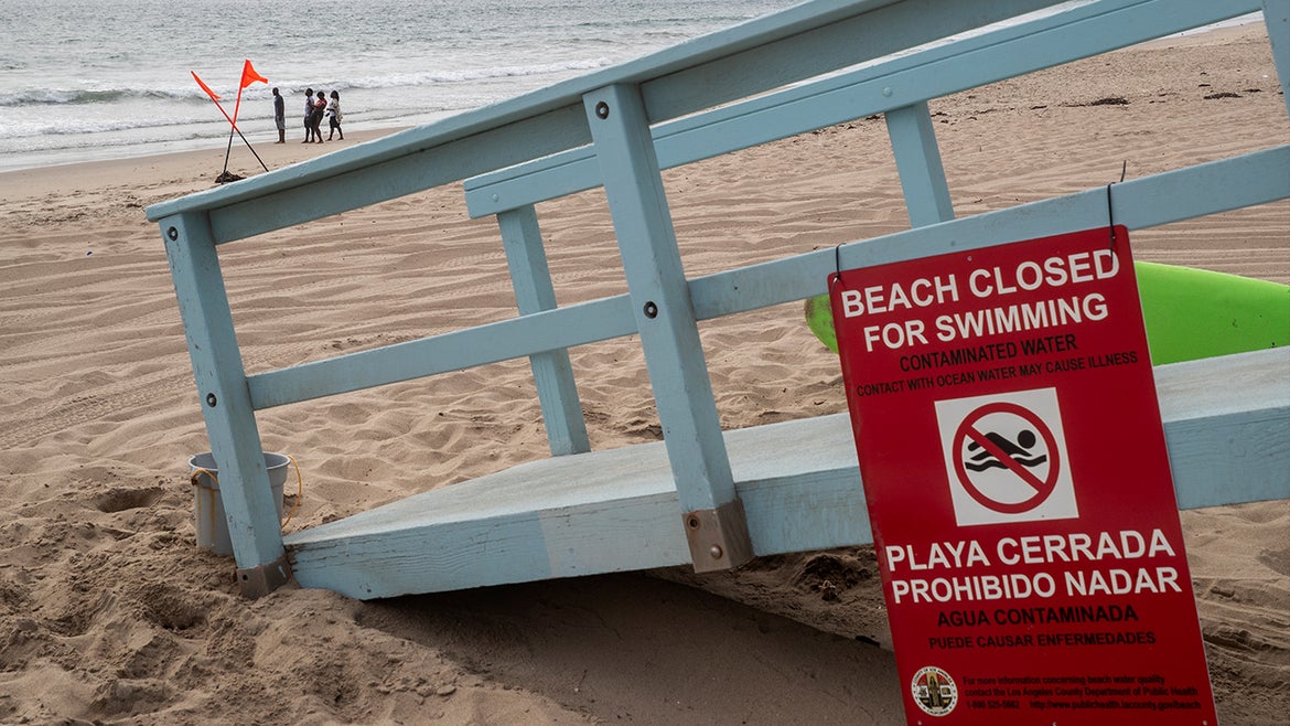 A sign at Dockweiler State Beach in Playa del Rey announces the beach is closed.