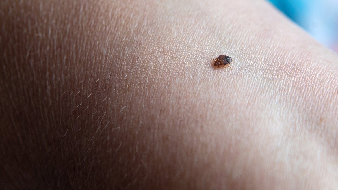23 June 2021, Lower Saxony, Delmenhorst: A bedbug bites an arm. Bed bugs are not at all uncommon. 