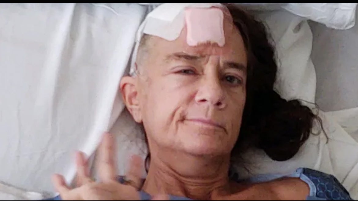 Volz with bandage on her head in hospital bed