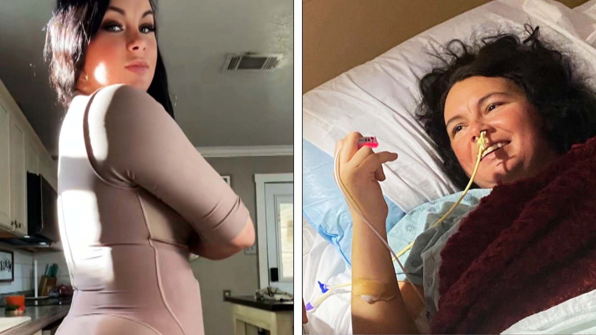 Woman's nipples die and fall off after botched plastic surgery