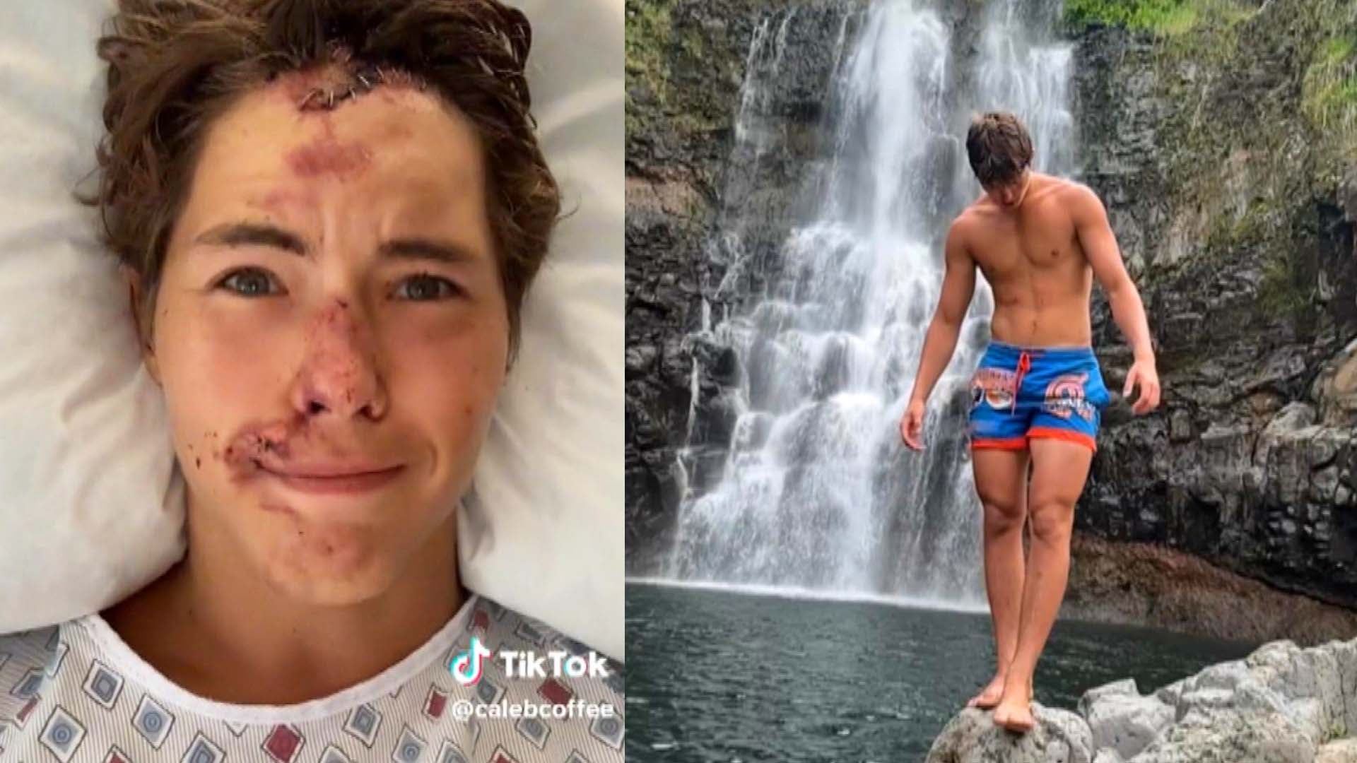 Caleb Coffee Talks to Fans From Hospital After 80-Foot Fall Off Cliff in  Hawaii | Inside Edition