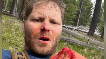 Army Vet Mauled by Grizzly Bear While on His Honeymoon