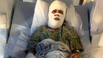 Ashley Wasielewski laying in a hospital bed with her entire face covered in bandages