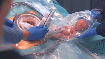 Fake baby being transferred to artificial womb in demonstration