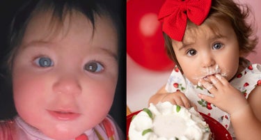 Meet the Baby Born With Two Different Color Eyes