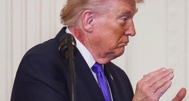 What Is On President Donald Trump's Neck?