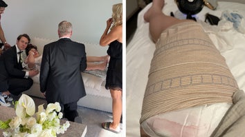 Bride Injured Leg Before Wedding