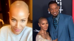Jada Pinkett-Smith Reveals Alopecia Has Left Her Bald and Scarred