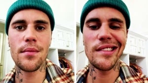 Justin Bieber Reveals Half His Face Is Paralyzed Due to Ramsay Hunt Syndrome