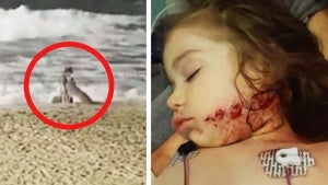 California Woman Plans to Sue Huntington Beach After Coyote Attacks Her Daughter