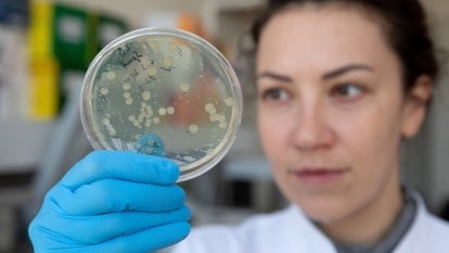 An employee controlling the growth of a bacterial colony where a plasmid containing a gene without mutation was conjugated at the genome editing laboratory of the Bochkov Research Center for Medical Genetics
