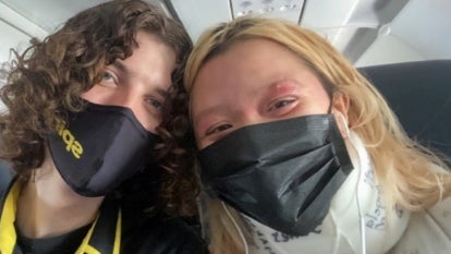 Woman Almost Kicked Off Flight Over Mistaken Belief She Had Monkeypox 