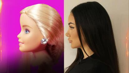 Woman Undergoes Surgery to Get Barbie-Inspired Nose