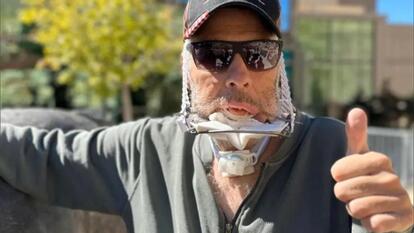 Grizzly Bear Bites Off Man’s Jaw