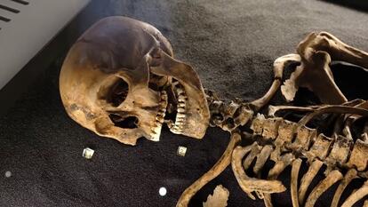 Museums are grappling with how to handle skeletons, mummies, and human remains.