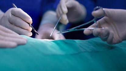 Stock image of doctors performing surgery