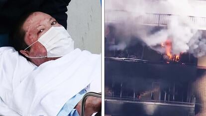 Man on gurney with facemask/Building fire