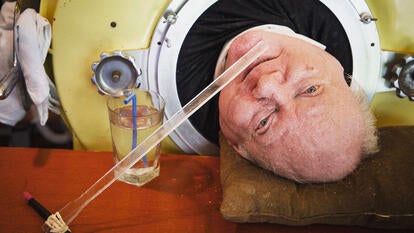 Paul Alexander, the longest living polio survivor in an iron lung, has died at the age of 78.