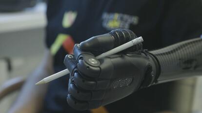 Bionic prosthetic arm