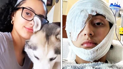 Woman blinded by retractable leash