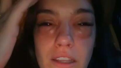 TikToker Rushed to Hospital After Going to Pickle Festival