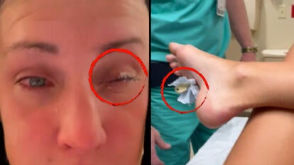 woman with eye stuck closed / foot with a key sticking out of it