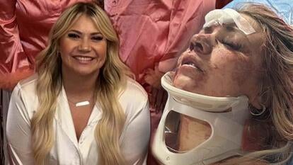 Canada Rinaldi in white / Canada Rinaldi in a neck brace with a bruised face