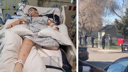 Victor Perez in hospital / police shooting