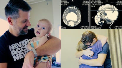 Man holding a baby, MRI of child's brain, parents hugging each other