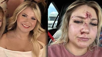 Canada Rinaldi in a white dress / Canada Rinaldi with cuts and bruising on her swollen face