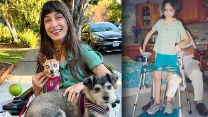 Woman in a wheelchair holding two dogs / Young girl standing with crutches