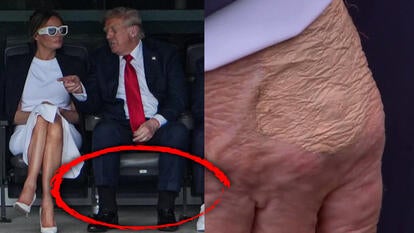 Donald Trump, red circle around his swollen ankles, close-up of his hand with concealing makeup on it