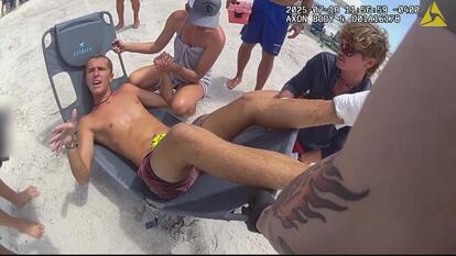 Shark bite victim Sam Hallis