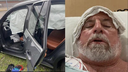 Crashed car, man in hospital bed