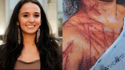 Natalie Greene, photo of Greene with slashes on her body