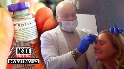 Hand holding up a vial of Botox / Doctor marking patient's face for Botox injection sites