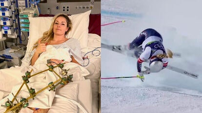 Lindsey Vonn in hospital, Vonn's skiing crash at the 2026 Winter Olympics