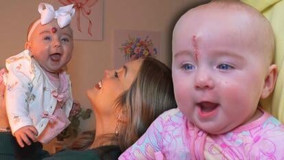 Baby Emory Risner smiling as mother, Bree Risner, lifts her into the air / Baby Emory Risner post-op with a wound above her right eyebrow 
