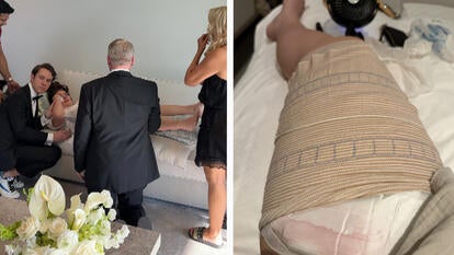 Bride Injured Leg Before Wedding