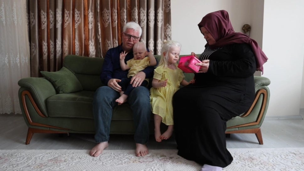 How This Family of 4 Navigates Living With Albinism