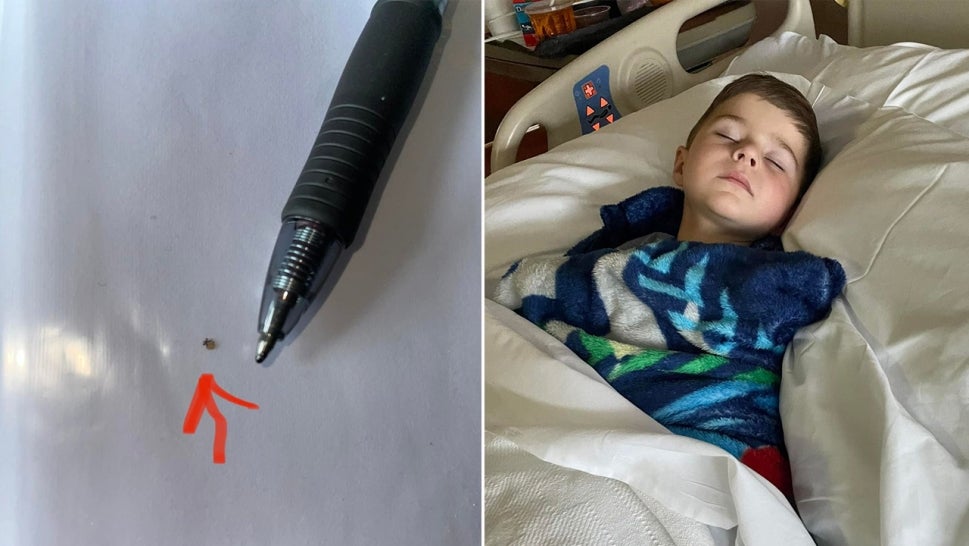 From left: Image of tick compared to point of pen, on right, image of jonny in hospital bed.