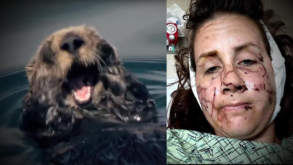 Woman Survives Vicious River Otter Attack
