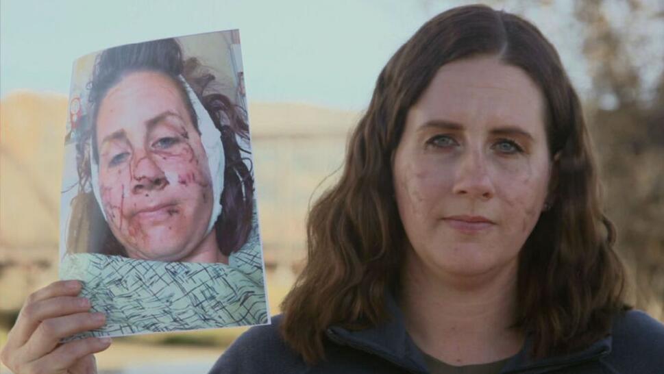 Jen Royce holding a picture of her in the hospital with injuries up her her face