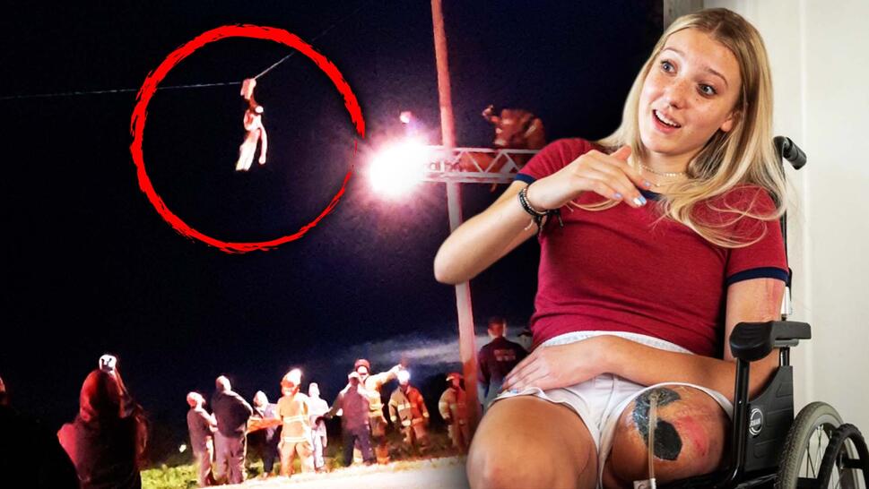 Teen Loses Leg After Crash Left Her Hanging From Power Line