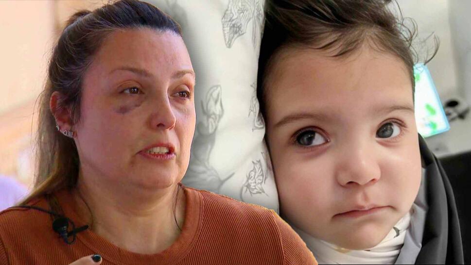 Woman with a black eye being interviewed / Baby laying down on blankets