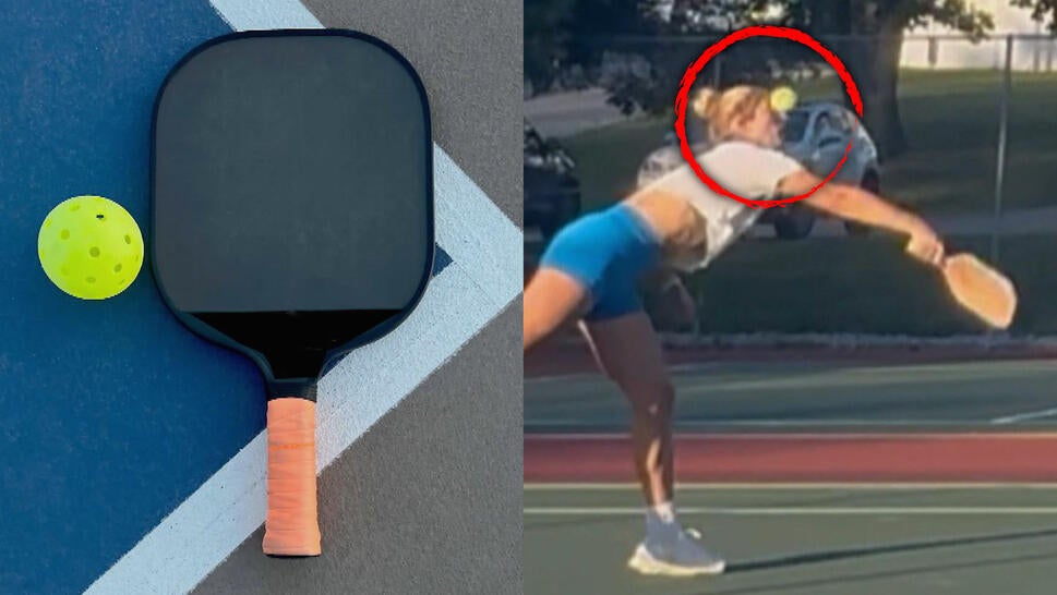 Pickleball and paddle, woman being hit in the eye with pickleball