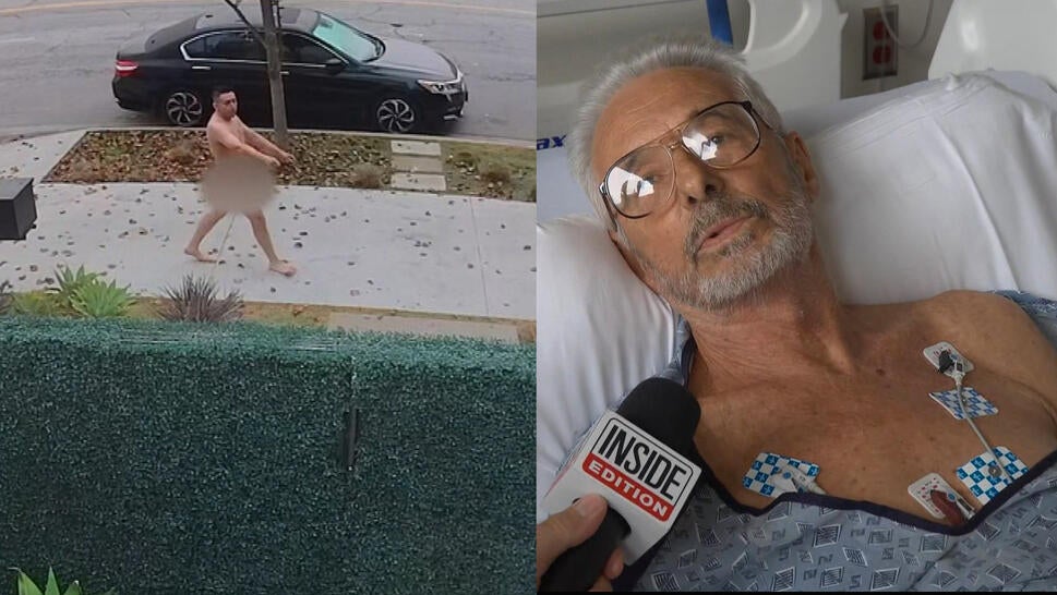 Naked man walking in neighborhood, George Karkoc hospitalized