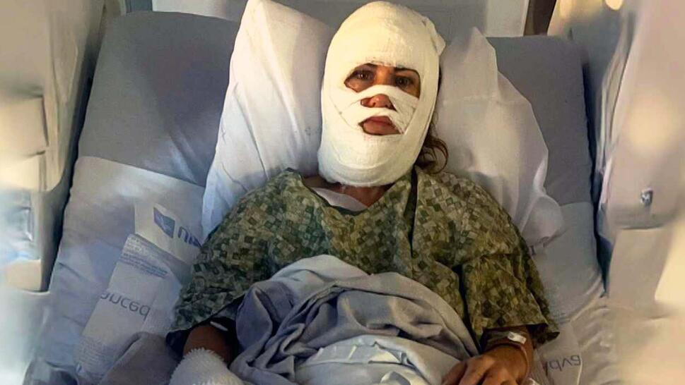 Ashley Wasielewski laying in a hospital bed with her entire face covered in bandages